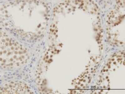 Immunohistochemistry-Paraffin: RASSF8 Antibody (2G1) [H00011228-M01]