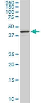 Western Blot: RASSF8 Antibody (2G1) [H00011228-M01]