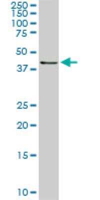 Western Blot: RASSF8 Antibody (2G1) [H00011228-M01]