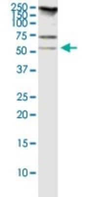 Western Blot: RASSF8 Antibody (2G1) [H00011228-M01]