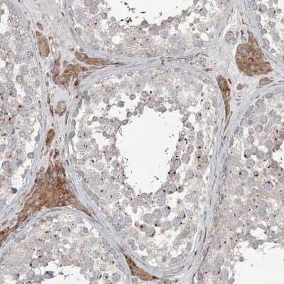 Immunohistochemistry: RASSF8 Antibody [NBP2-38395]