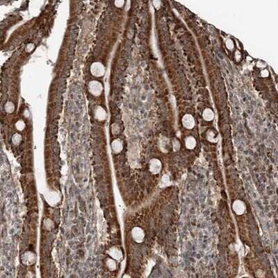 Immunohistochemistry-Paraffin: RASSF8 Antibody [NBP1-88388]