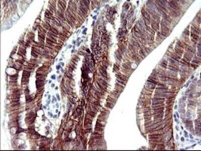 Immunohistochemistry: RASSF8 Antibody (OTI1F5) - Azide and BSA Free [NBP2-73820]
