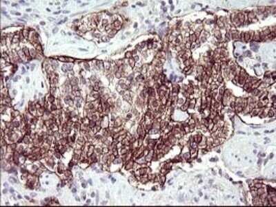 Immunohistochemistry: RASSF8 Antibody (OTI1F5) - Azide and BSA Free [NBP2-73820]