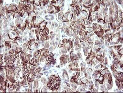 Immunohistochemistry: RASSF8 Antibody (OTI1F5) - Azide and BSA Free [NBP2-73820]