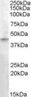 Western Blot: RASSF8 Antibody [NBP1-00233]