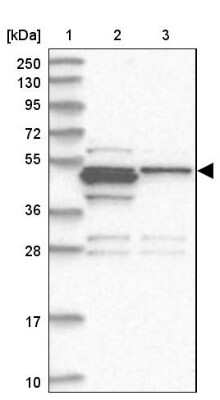 Western Blot: RASSF8 Antibody [NBP1-88388]