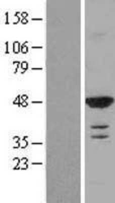 Western Blot: RASSF8 Overexpression Lysate [NBL1-15180]