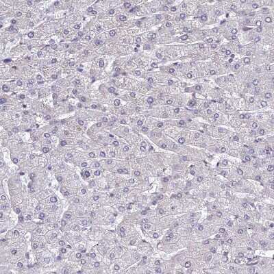 Immunohistochemistry-Paraffin: RAVER1 Antibody [NBP2-48795]