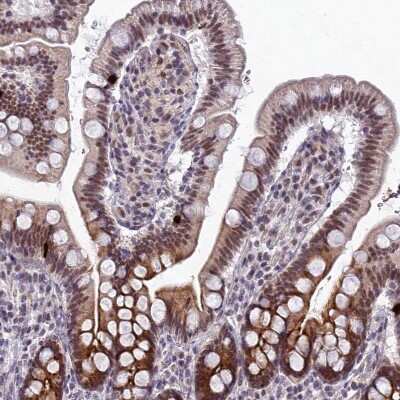 Immunohistochemistry-Paraffin: RAVER1 Antibody [NBP2-48795]