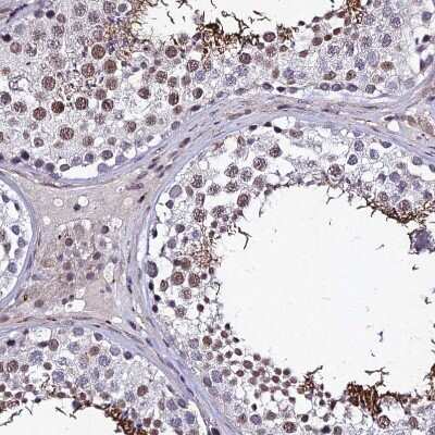 Immunohistochemistry-Paraffin: RAVER1 Antibody [NBP2-48795]