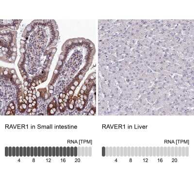 Immunohistochemistry-Paraffin: RAVER1 Antibody [NBP2-48795]