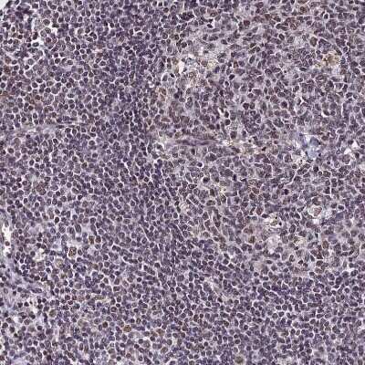 Immunohistochemistry-Paraffin: RAVER1 Antibody [NBP2-48795]