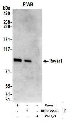 Immunoprecipitation: RAVER1 Antibody [NBP2-22291]
