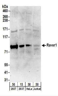 Western Blot: RAVER1 Antibody [NBP2-22291]