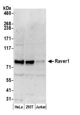 Western Blot: RAVER1 Antibody [NBP2-22291]