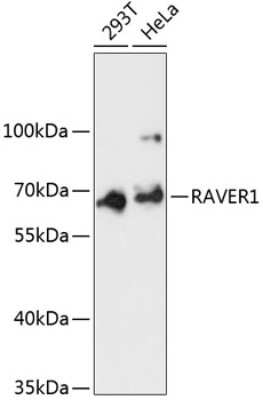 Western Blot: RAVER1 AntibodyAzide and BSA Free [NBP2-94413]