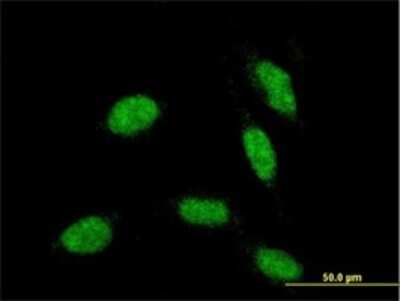 Immunocytochemistry/ Immunofluorescence: RAX Antibody (4F4) [H00030062-M02]