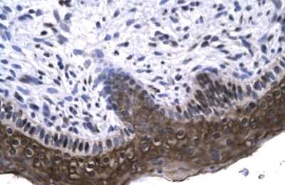 Immunohistochemistry: RAX Antibody [NBP2-86764]