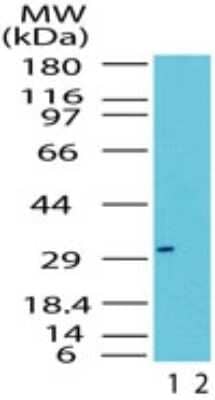 Western Blot: RAX Antibody [NB100-56467]