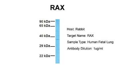 Western Blot: RAX Antibody [NBP2-86764]