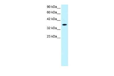 Western Blot: RAX Antibody [NBP2-86765]