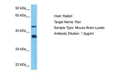 Western Blot: RAX Antibody [NBP2-86766]