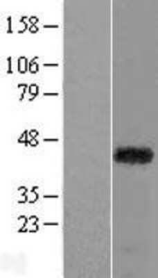 Western Blot: RAX Overexpression Lysate [NBL1-15182]