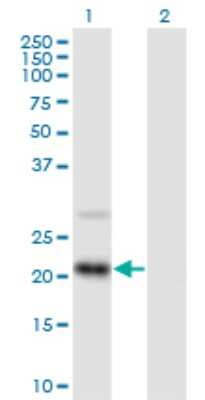 Western Blot: RAX2 Antibody [H00084839-B01P]