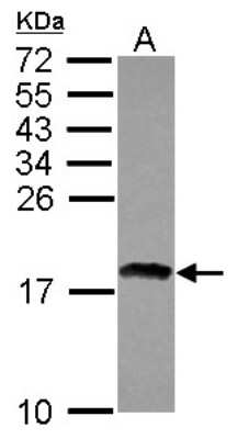 Western Blot: RAX2 Antibody [NBP2-15092]