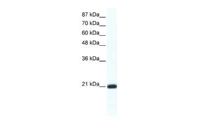 Western Blot: RAX2 Antibody [NBP2-88130]