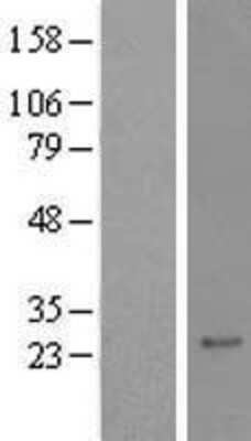 Western Blot: RAX2 Overexpression Lysate [NBL1-15183]