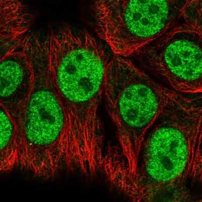 Immunocytochemistry/ Immunofluorescence: RB associated KRAB repressor Antibody [NBP2-55962]