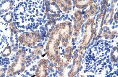 Immunohistochemistry: RB associated KRAB repressor Antibody [NBP2-85608]