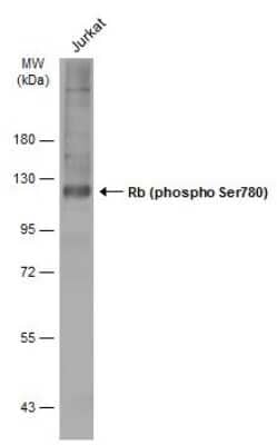 Western Blot: RB1 [p Ser780] Antibody [NBP3-13308]