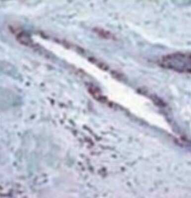 Immunohistochemistry: RB1 Antibody (172C1094) - (cleaved) - Azide and BSA Free [NBP2-33240]