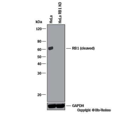 Western Blot: RB1 Antibody (172C1094)(cleaved)Azide and BSA Free [NBP2-33240]