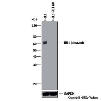 Knockdown Validated: RB1 Antibody (172C1094) - (cleaved) [NB100-56598]