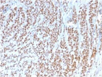 Immunohistochemistry-Paraffin: RB1 Antibody (1F8) - Azide and BSA Free [NBP2-54483]