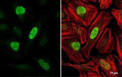 Immunocytochemistry/ Immunofluorescence: RB1 Antibody [NBP2-20127]