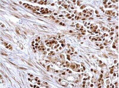 Immunohistochemistry-Paraffin: RB1 Antibody [NBP2-20127]