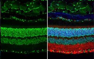 Immunohistochemistry-Paraffin: RB1 Antibody [NBP2-20127]