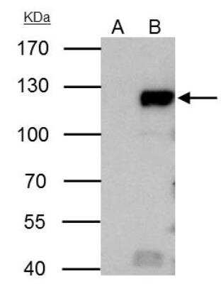 Immunoprecipitation: RB1 Antibody [NBP2-20127]