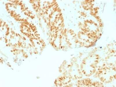 Immunohistochemistry-Paraffin: RB1 Antibody (RB1/1754) - Azide and BSA Free [NBP2-54476]