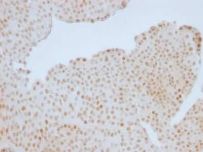 Immunohistochemistry-Paraffin: RB1 Antibody (RB1/1754) - Azide and BSA Free [NBP2-54476]
