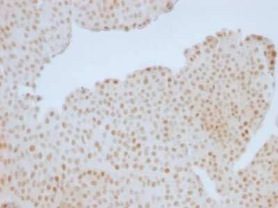 Immunohistochemistry-Paraffin: RB1 Antibody (RB1/1754) [NBP2-53400]