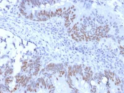 Immunohistochemistry-Paraffin: RB1 Antibody (RB1/2313R) - Azide and BSA Free [NBP3-08940]