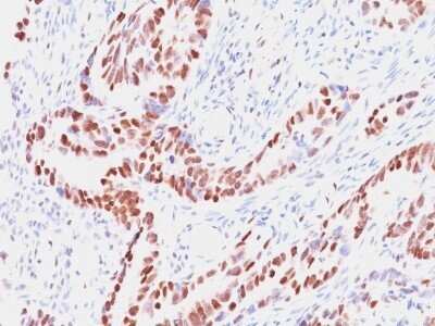 Immunohistochemistry-Paraffin: RB1 Antibody (SPM353) [NBP2-53399]