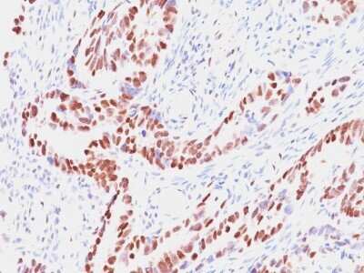 Immunohistochemistry-Paraffin: RB1 Antibody (SPM353) - Azide and BSA Free [NBP2-54477]