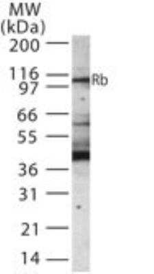 Western Blot: RB1 Antibody [NB100-56888]